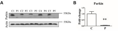 Exploring the Impact of PARK2 Mutations on the Total and Mitochondrial Proteome of Human Skin Fibroblasts